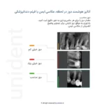 اسکنر فسفرپلیت وودپکر Woodpecker مدل Free Scan - Image 4