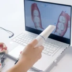 اسکنر داخل دهانی مدیت Medit مدل i900 - Image 3