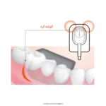 سنسور RVG واتک Vatech سایز 1.5 مدل EZ Sensor Classic - Image 7